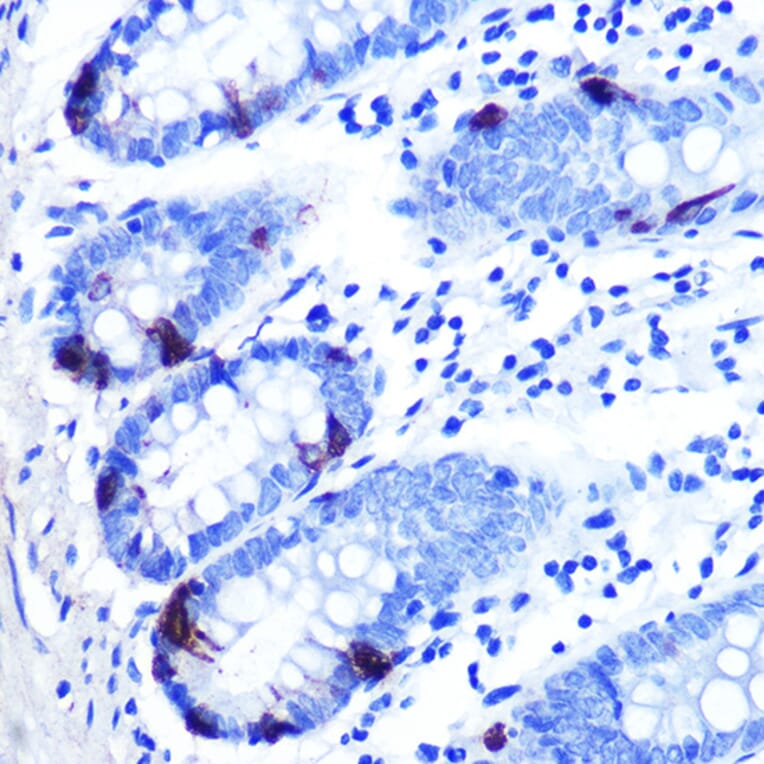 Immunohistochemistry - Anti-Zinc Alpha 2 Glycoprotein Antibody [ARC0673] (A80702) - Antibodies.com