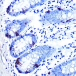 Immunohistochemistry - Anti-Zinc Alpha 2 Glycoprotein Antibody [ARC0673] (A80702) - Antibodies.com