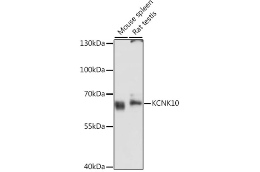 Western Blot - Anti-KCNK10 Antibody (A11681) - Antibodies.com