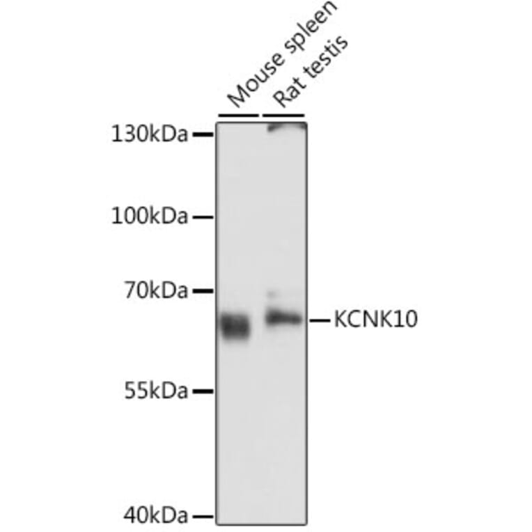Western Blot - Anti-KCNK10 Antibody (A11681) - Antibodies.com