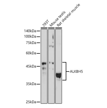 Western Blot - Anti-ALKBH5 Antibody (A80704) - Antibodies.com