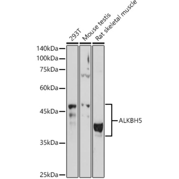 Western Blot - Anti-ALKBH5 Antibody (A80704) - Antibodies.com