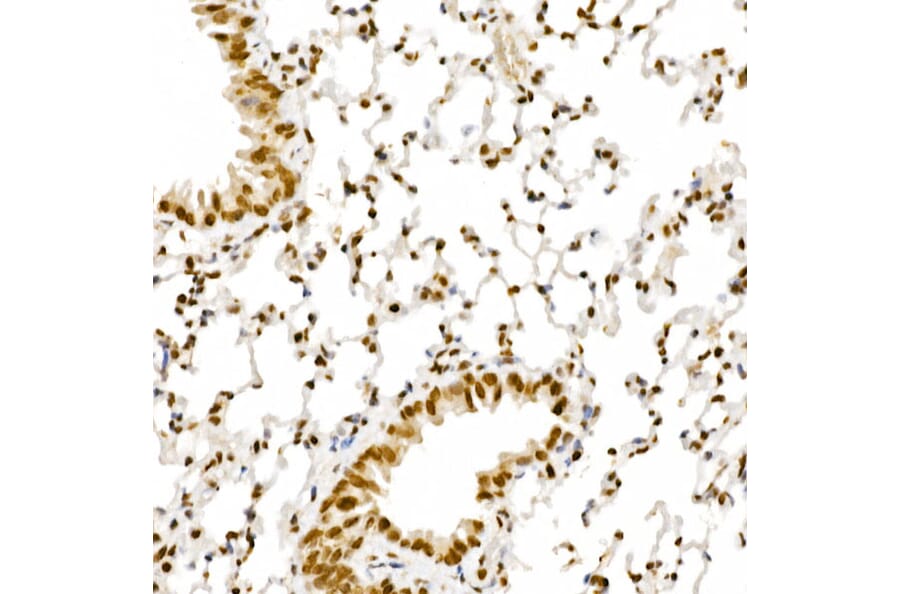 Immunohistochemistry - Anti-ALKBH5 Antibody (A80704) - Antibodies.com
