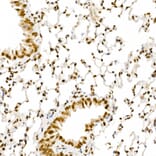 Immunohistochemistry - Anti-ALKBH5 Antibody (A80704) - Antibodies.com