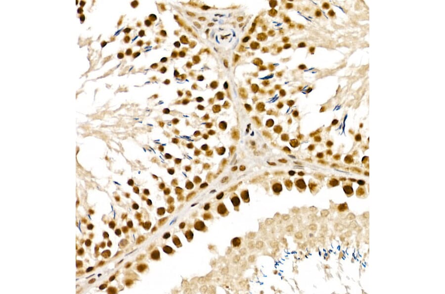 Immunohistochemistry - Anti-ALKBH5 Antibody (A80704) - Antibodies.com