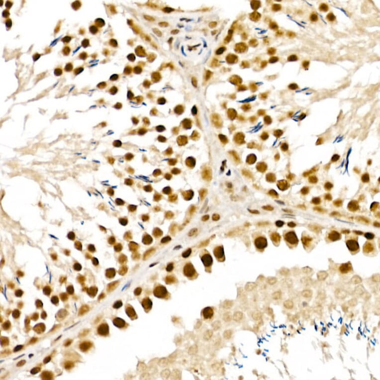 Immunohistochemistry - Anti-ALKBH5 Antibody (A80704) - Antibodies.com