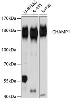 Western blot analysis of extracts of various cell lines, using Anti-CHAMP1 Antibody (A11690) at 1:3000 dilution.
Secondary antibody: Goat Anti-Rabbit IgG (H+L) (HRP) (AS014) at 1:10,000 dilution.
Lysates / proteins: 25µg per lane.
Blocking buffer: 3% non-fat dry milk in TBST.
Detection: ECL Basic Kit (RM00020).
Exposure time: 1s.