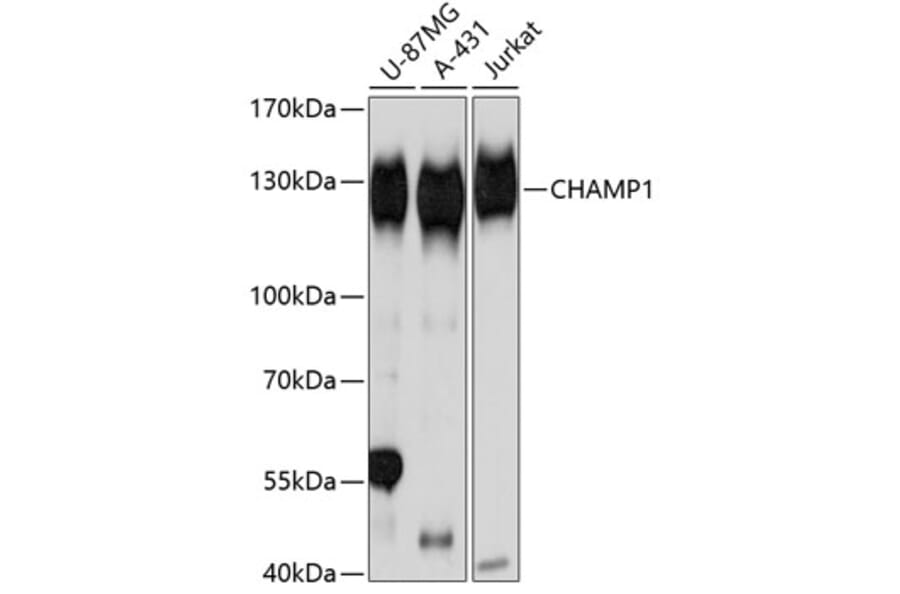 Western Blot - Anti-CHAMP Antibody (A80705) - Antibodies.com