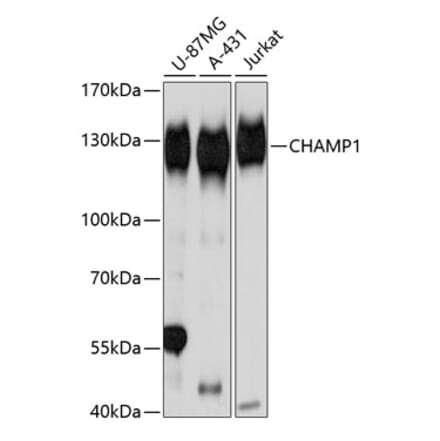 Western Blot - Anti-CHAMP Antibody (A80705) - Antibodies.com