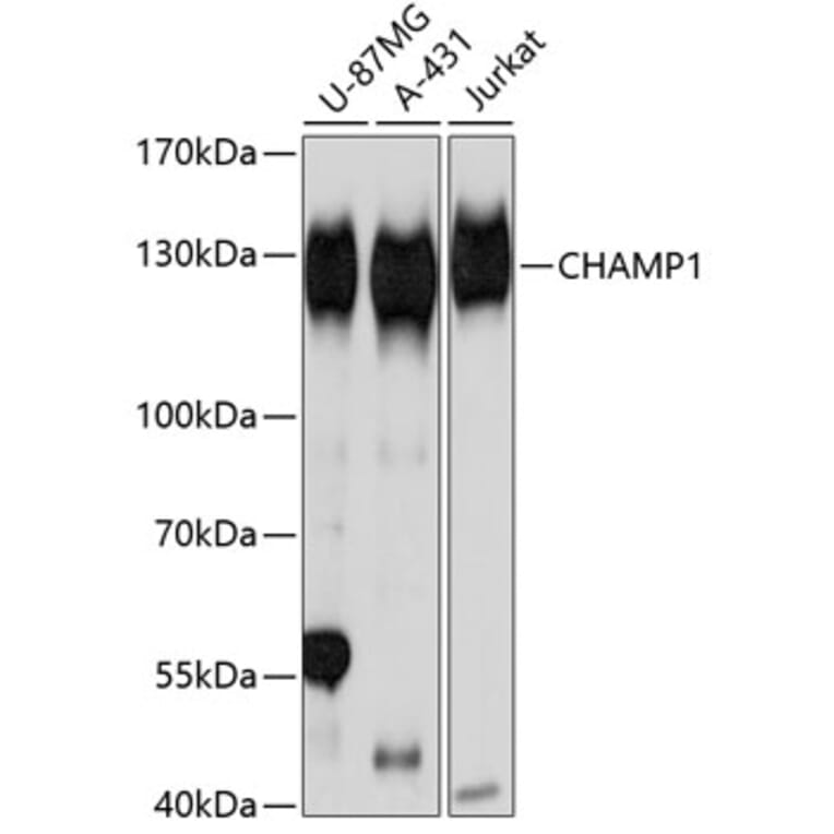 Western Blot - Anti-CHAMP Antibody (A80705) - Antibodies.com
