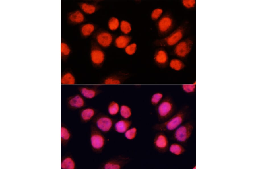 Immunofluorescence - Anti-CHAMP Antibody (A80705) - Antibodies.com
