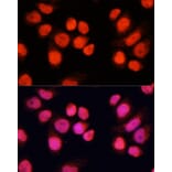 Immunofluorescence - Anti-CHAMP Antibody (A80705) - Antibodies.com