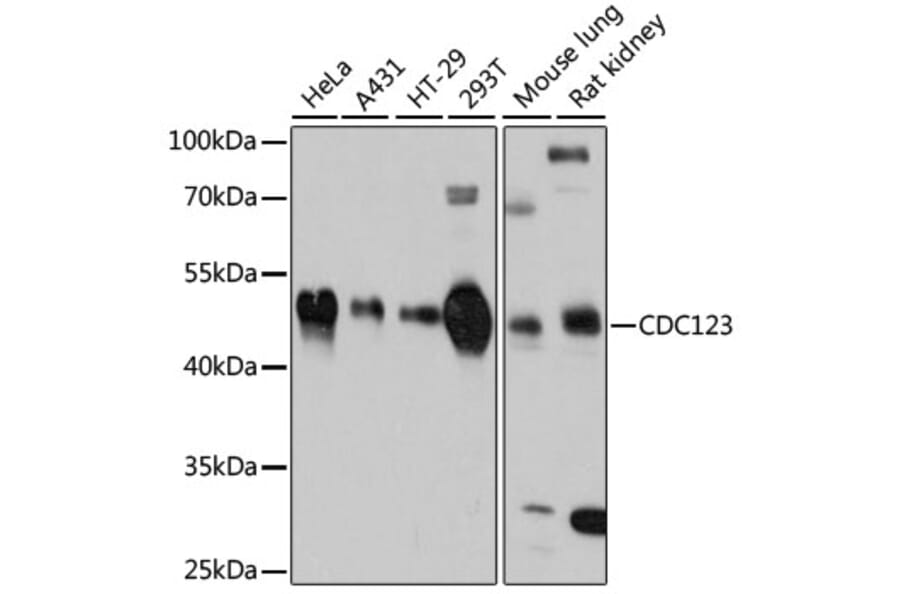Western Blot - Anti-CDC123 Antibody (A80706) - Antibodies.com