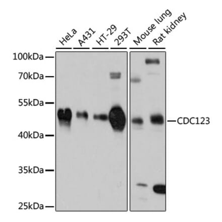 Western Blot - Anti-CDC123 Antibody (A80706) - Antibodies.com