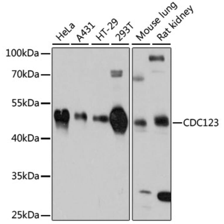 Western Blot - Anti-CDC123 Antibody (A80706) - Antibodies.com
