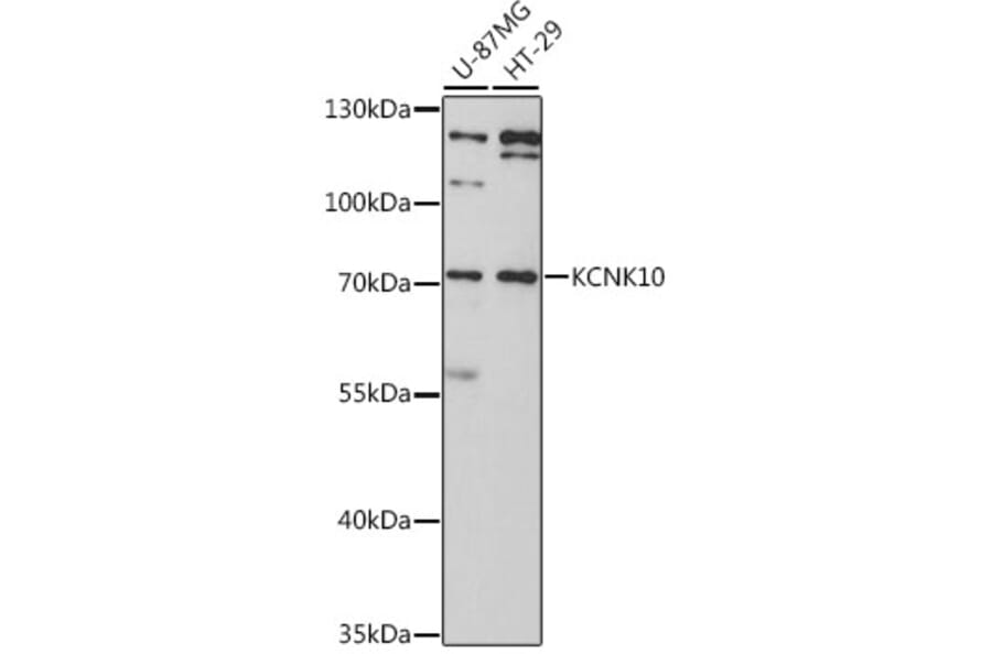 Western Blot - Anti-KCNK10 Antibody (A11696) - Antibodies.com