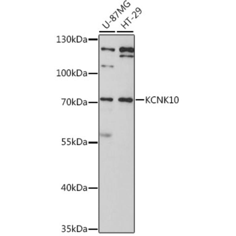 Western Blot - Anti-KCNK10 Antibody (A11696) - Antibodies.com