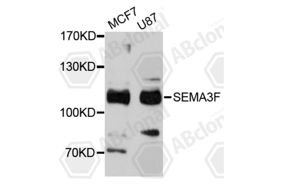 Western Blot - Anti-SEMA3F Antibody (A11713) - Antibodies.com