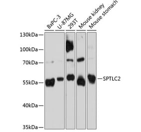 Western Blot - Anti-Serine Palmitoyltransferase Antibody (A80711) - Antibodies.com