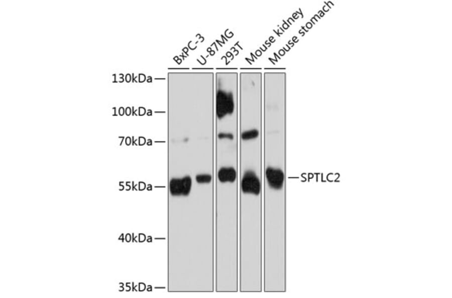 Western Blot - Anti-Serine Palmitoyltransferase Antibody (A80711) - Antibodies.com