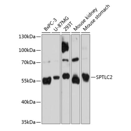 Western Blot - Anti-Serine Palmitoyltransferase Antibody (A80711) - Antibodies.com