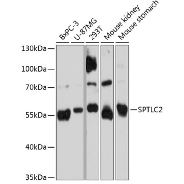 Western Blot - Anti-Serine Palmitoyltransferase Antibody (A80711) - Antibodies.com