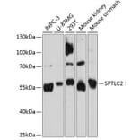 Western Blot - Anti-Serine Palmitoyltransferase Antibody (A80711) - Antibodies.com