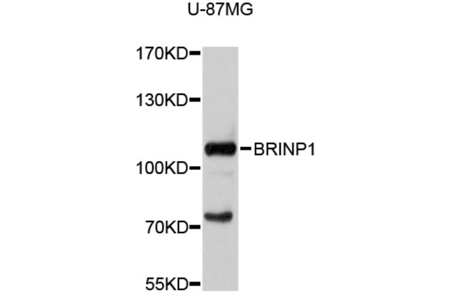 Western Blot - Anti-BRINP1 Antibody (A11723) - Antibodies.com