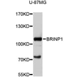 Western Blot - Anti-BRINP1 Antibody (A11723) - Antibodies.com