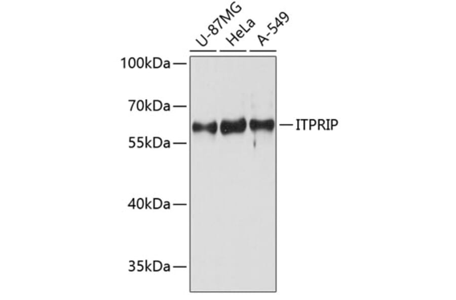 Western Blot - Anti-ITPRIP Antibody (A80713) - Antibodies.com