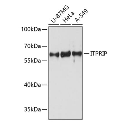 Western Blot - Anti-ITPRIP Antibody (A80713) - Antibodies.com