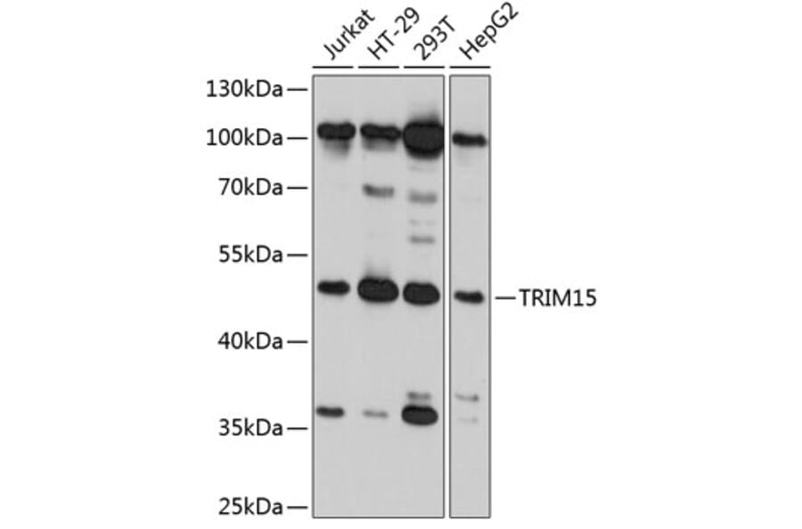 Western Blot - Anti-RNF93 Antibody (A80714) - Antibodies.com