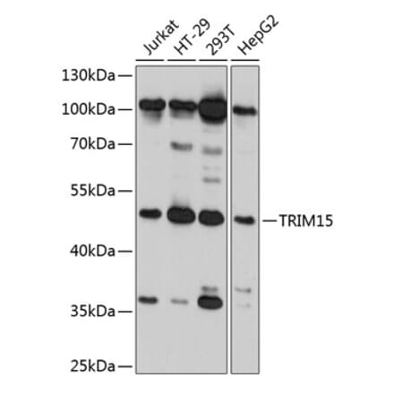 Western Blot - Anti-RNF93 Antibody (A80714) - Antibodies.com