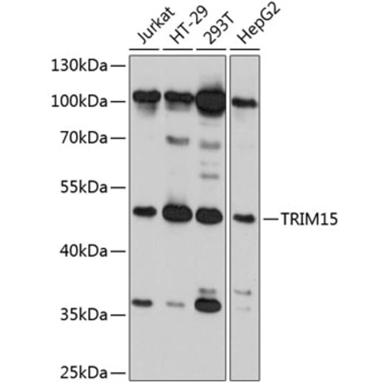 Western Blot - Anti-RNF93 Antibody (A80714) - Antibodies.com