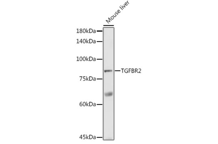 Western Blot - Anti-TGF beta Receptor II Antibody (A80716) - Antibodies.com