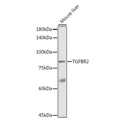 Western Blot - Anti-TGF beta Receptor II Antibody (A80716) - Antibodies.com