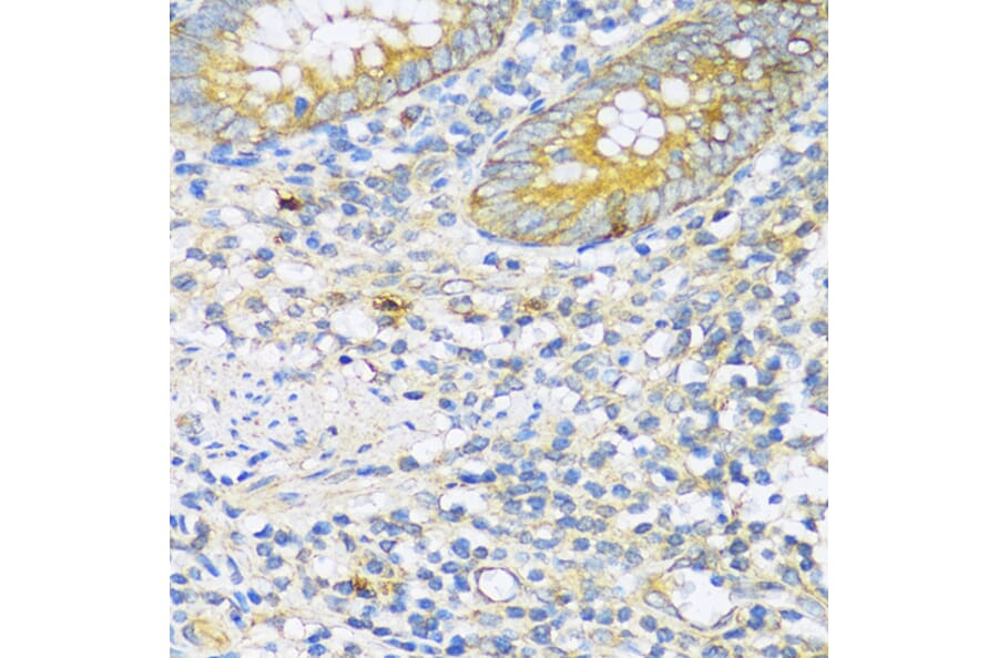 Immunohistochemistry - Anti-TGF beta Receptor II Antibody (A80716) - Antibodies.com