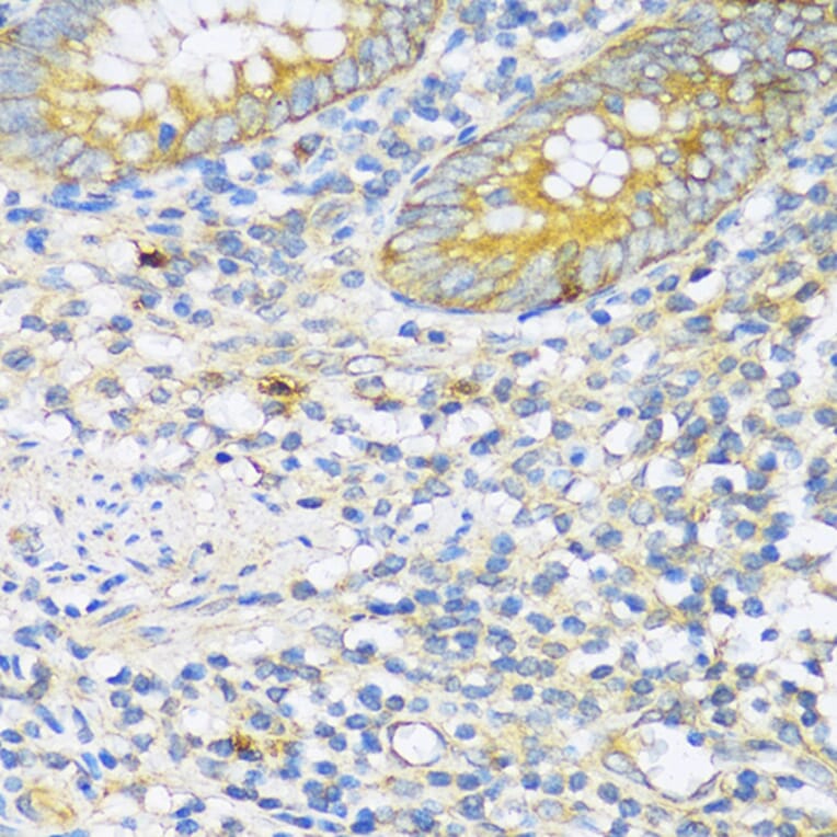 Immunohistochemistry - Anti-TGF beta Receptor II Antibody (A80716) - Antibodies.com