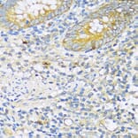 Immunohistochemistry - Anti-TGF beta Receptor II Antibody (A80716) - Antibodies.com