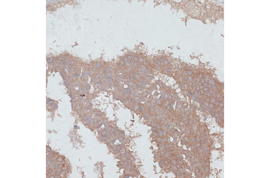 Immunohistochemistry - Anti-TGF beta Receptor II Antibody (A80716) - Antibodies.com