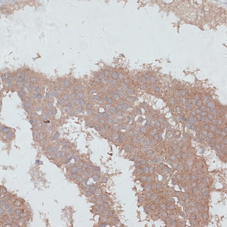 Immunohistochemistry - Anti-TGF beta Receptor II Antibody (A80716) - Antibodies.com