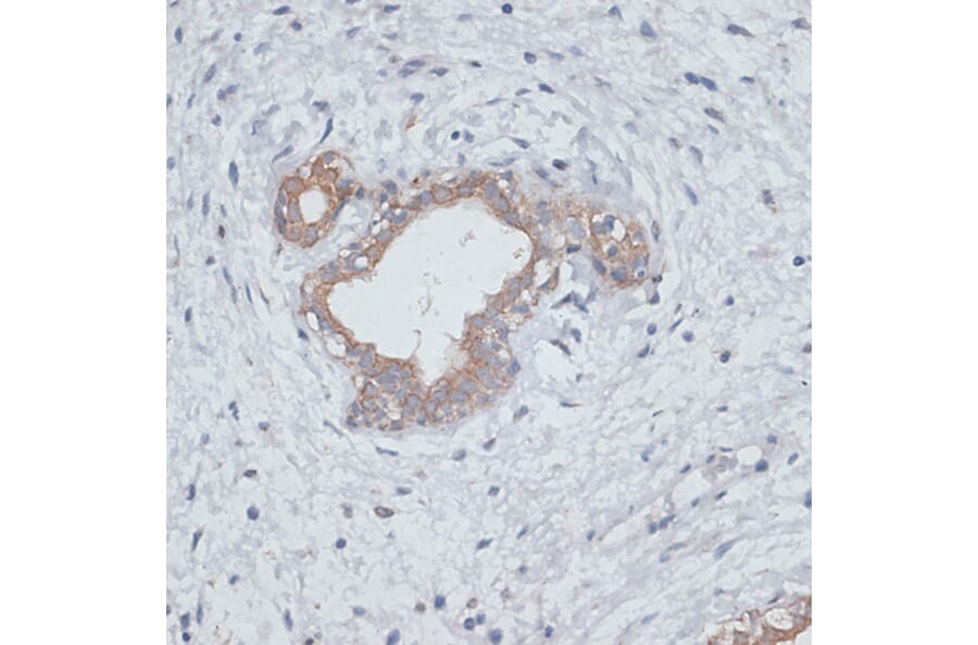 Immunohistochemistry - Anti-TGF beta Receptor II Antibody (A80716) - Antibodies.com