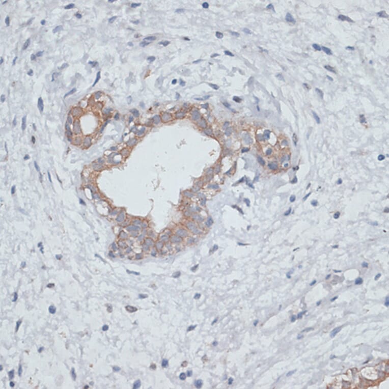 Immunohistochemistry - Anti-TGF beta Receptor II Antibody (A80716) - Antibodies.com
