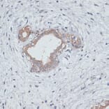 Immunohistochemistry - Anti-TGF beta Receptor II Antibody (A80716) - Antibodies.com