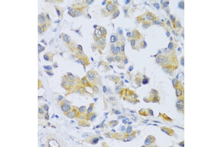 Immunohistochemistry - Anti-TGF beta Receptor II Antibody (A80716) - Antibodies.com