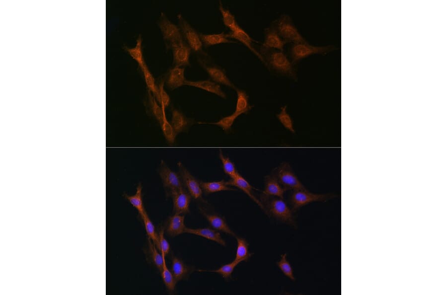 Immunofluorescence - Anti-TGF beta Receptor II Antibody (A80716) - Antibodies.com