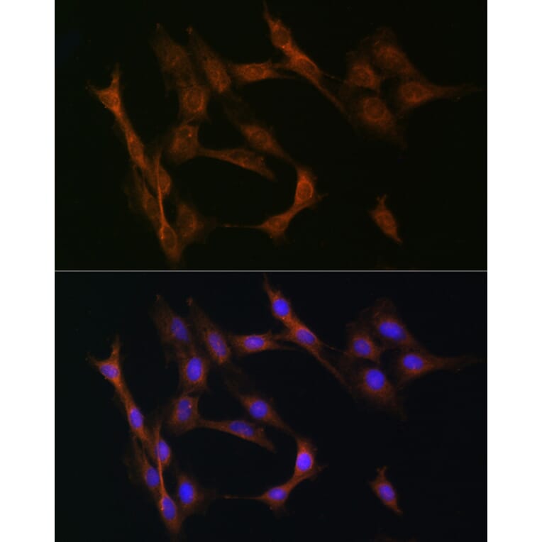 Immunofluorescence - Anti-TGF beta Receptor II Antibody (A80716) - Antibodies.com