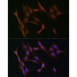 Immunofluorescence - Anti-TGF beta Receptor II Antibody (A80716) - Antibodies.com