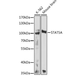 Western Blot - Anti-STAT5 Antibody (A80718) - Antibodies.com