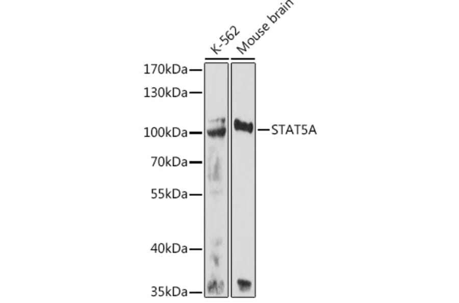 Western Blot - Anti-STAT5 Antibody (A80718) - Antibodies.com